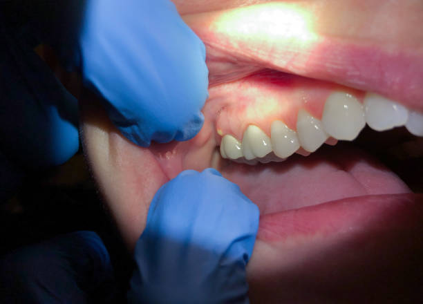 Best Emergency TMJ Treatment in Lake Waccamaw, NC