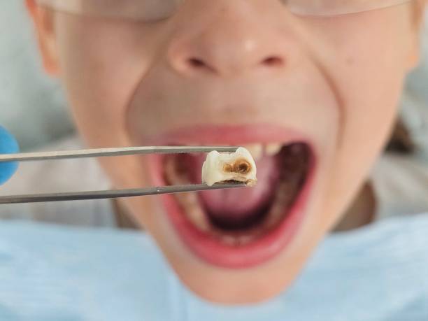 Best Urgent Care for Lost Fillings or Crowns in Lake Waccamaw, NC